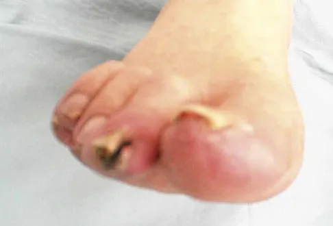 Foot & Ankle Board Review 2009: High-Yield MCQs (Set 4) - Figure 24