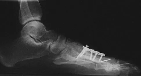 Foot & Ankle Board Review 2009: High-Yield MCQs (Set 4) - Figure 9