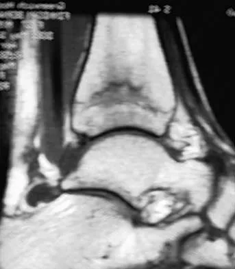 Foot & Ankle 2026 MCQs: Board Review Questions & Answers (Part 1) - Figure 11