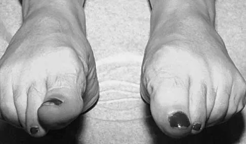 Foot & Ankle 2026 MCQs: Board Review Questions & Answers (Part 1) - Figure 113