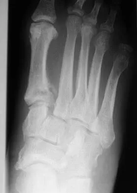 Foot & Ankle 2026 MCQs: Board Review Questions & Answers (Part 1) - Figure 129