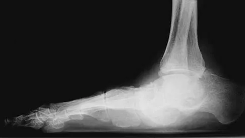 Foot & Ankle 2026 MCQs: Board Review Questions & Answers (Part 1) - Figure 141