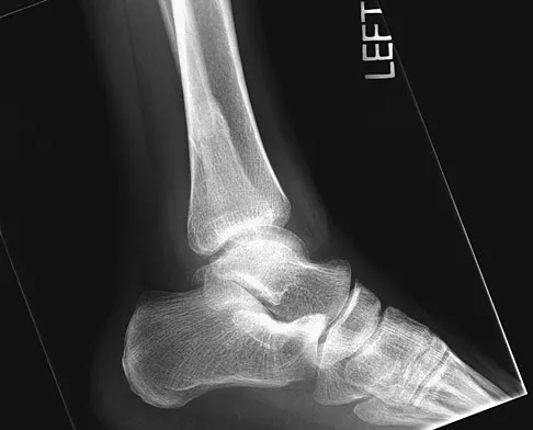 Foot & Ankle 2026 MCQs: Board Review Questions & Answers (Part 1) - Figure 151