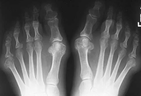 Foot & Ankle 2026 MCQs: Board Review Questions & Answers (Part 1) - Figure 25