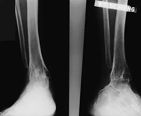 Foot & Ankle 2026 MCQs: Board Review Questions & Answers (Part 1) - Figure 41