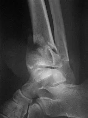 Foot & Ankle 2026 MCQs: Board Review Questions & Answers (Part 1) - Figure 67