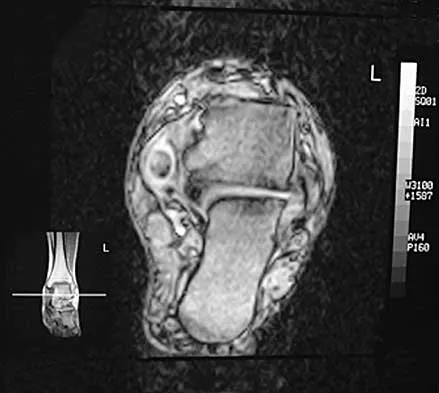 Foot & Ankle 2026 MCQs: Board Review Questions & Answers (Part 1) - Figure 73