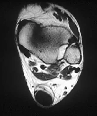 Foot & Ankle 2026 MCQs: Board Review Questions & Answers (Part 1) - Figure 83