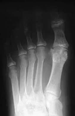 Foot & Ankle 2026 MCQs: Board Review Questions & Answers (Part 1) - Figure 97