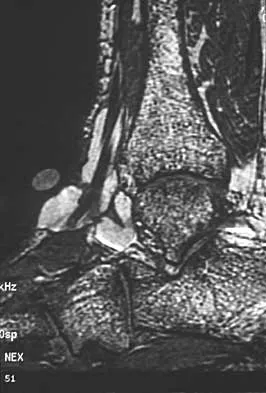 Foot & Ankle 2026 MCQs: Board Review Questions & Answers (Part 1) - Figure 99