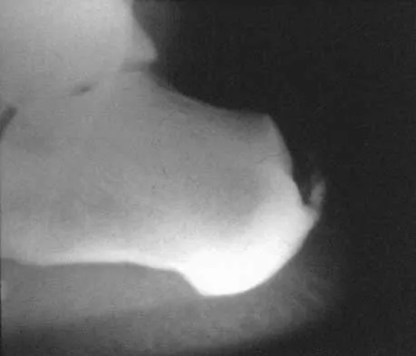 Foot & Ankle 2026 MCQs: Board Review Questions & Answers (Part 2) - Figure 101