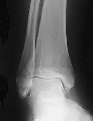 Foot & Ankle 2026 MCQs: Board Review Questions & Answers (Part 2) - Figure 117