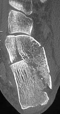 Foot & Ankle 2026 MCQs: Board Review Questions & Answers (Part 2) - Figure 127