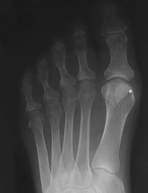 Foot & Ankle 2026 MCQs: Board Review Questions & Answers (Part 2) - Figure 137