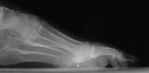 Foot & Ankle 2026 MCQs: Board Review Questions & Answers (Part 2) - Figure 139