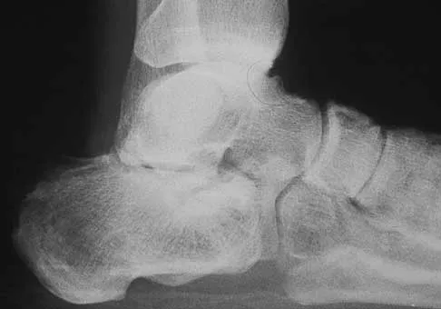 Foot & Ankle 2026 MCQs: Board Review Questions & Answers (Part 2) - Figure 31