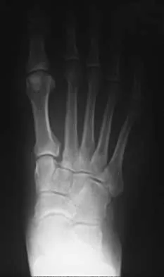 Foot & Ankle 2026 MCQs: Board Review Questions & Answers (Part 2) - Figure 33