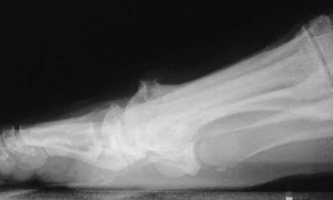 Foot & Ankle 2026 MCQs: Board Review Questions & Answers (Part 2) - Figure 45