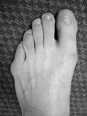 Foot & Ankle 2026 MCQs: Board Review Questions & Answers (Part 2) - Figure 49