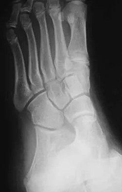 Foot & Ankle 2026 MCQs: Board Review Questions & Answers (Part 2) - Figure 73