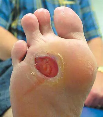 Foot & Ankle 2026 MCQs: Board Review Questions & Answers (Part 2) - Figure 99