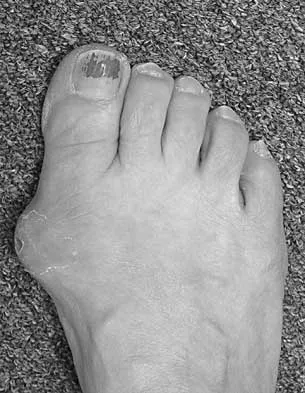 Foot & Ankle 2026 MCQs: Board Review Questions & Answers (Part 3) - Figure 11