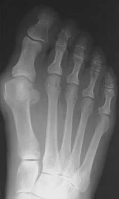 Foot & Ankle 2026 MCQs: Board Review Questions & Answers (Part 3) - Figure 13