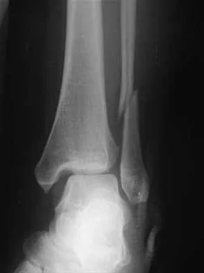 Foot & Ankle 2026 MCQs: Board Review Questions & Answers (Part 3) - Figure 19