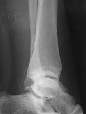 Foot & Ankle 2026 MCQs: Board Review Questions & Answers (Part 3) - Figure 23