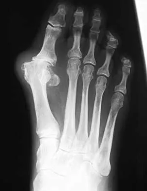 Foot & Ankle 2026 MCQs: Board Review Questions & Answers (Part 3) - Figure 29