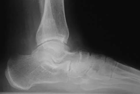 Foot & Ankle 2026 MCQs: Board Review Questions & Answers (Part 3) - Figure 5