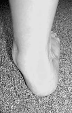 Foot & Ankle 2026 MCQs: Board Review Questions & Answers (Part 3) - Figure 7