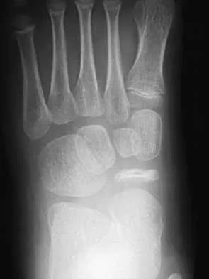 Foot & Ankle 2026 MCQs: Board Review Questions & Answers (Part 3) - Figure 9