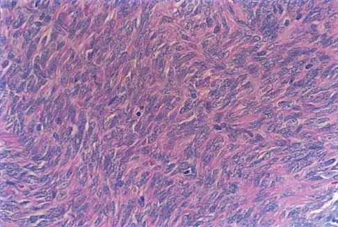 Foot & Ankle 2026 MCQs: Board Review Questions & Answers (Part 4) - Figure 11