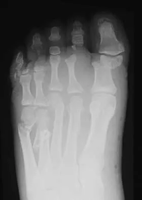 Foot & Ankle 2026 MCQs: Board Review Questions & Answers (Part 4) - Figure 13