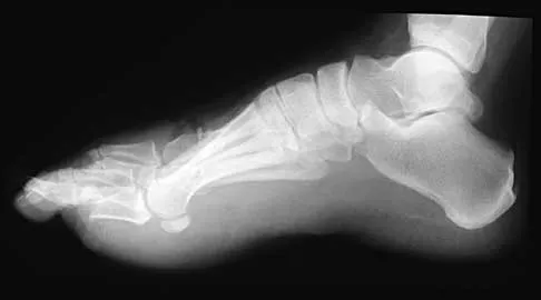 Foot & Ankle 2026 MCQs: Board Review Questions & Answers (Part 4) - Figure 15