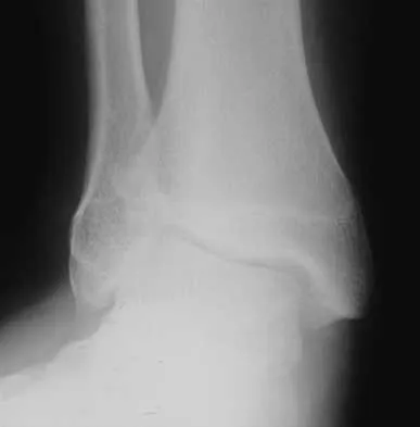 Foot & Ankle 2026 MCQs: Board Review Questions & Answers (Part 4) - Figure 31