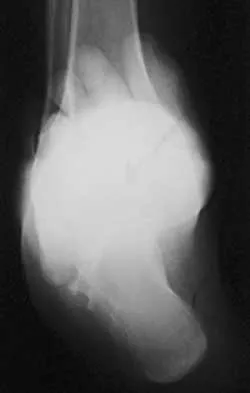 Foot & Ankle 2026 MCQs: Board Review Questions & Answers (Part 4) - Figure 39