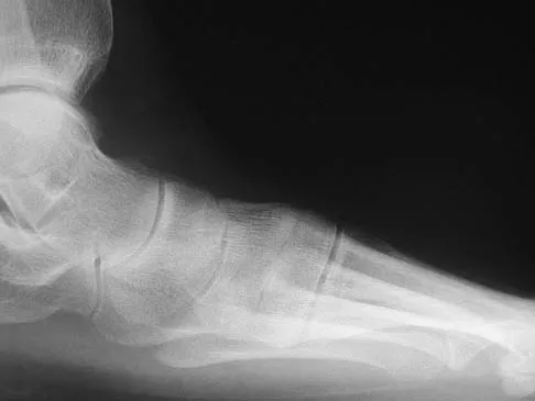 Foot & Ankle 2026 MCQs: Board Review Questions & Answers (Part 4) - Figure 43