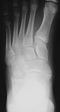 Foot & Ankle 2026 MCQs: Board Review Questions & Answers (Part 4) - Figure 5