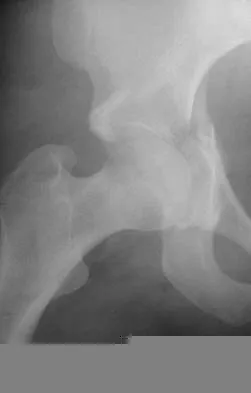 General Orthopedics 2026 Practice Questions: Set 17 (Solved) Figure 1