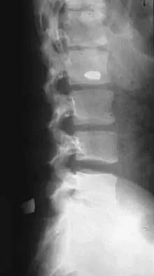 General Orthopedics 2026 Practice Questions: Set 1 (Solved) - Figure 10