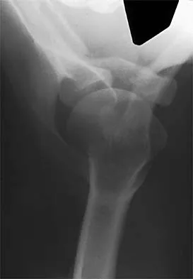 General Orthopedics 2026 Practice Questions: Set 1 (Solved) - Figure 100
