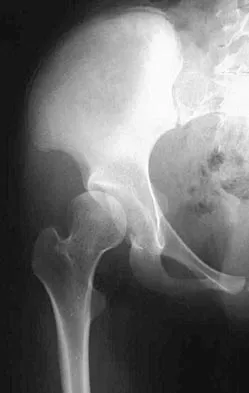 General Orthopedics 2026 Practice Questions: Set 1 (Solved) - Figure 19