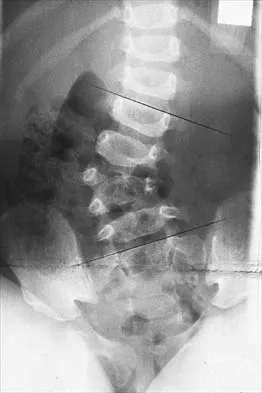 General Orthopedics 2026 Practice Questions: Set 1 (Solved) - Figure 2