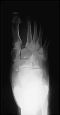 General Orthopedics 2026 Practice Questions: Set 1 (Solved) - Figure 21