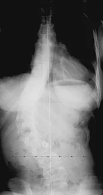 General Orthopedics 2026 Practice Questions: Set 1 (Solved) - Figure 23