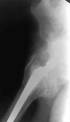 General Orthopedics 2026 Practice Questions: Set 1 (Solved) - Figure 27