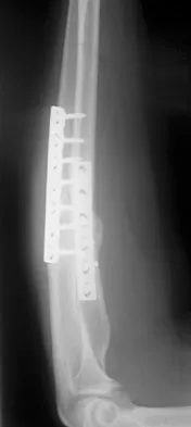 General Orthopedics 2026 Practice Questions: Set 1 (Solved) - Figure 29