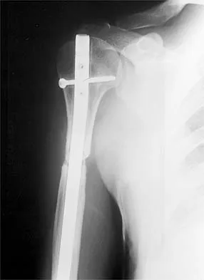 General Orthopedics 2026 Practice Questions: Set 1 (Solved) - Figure 30